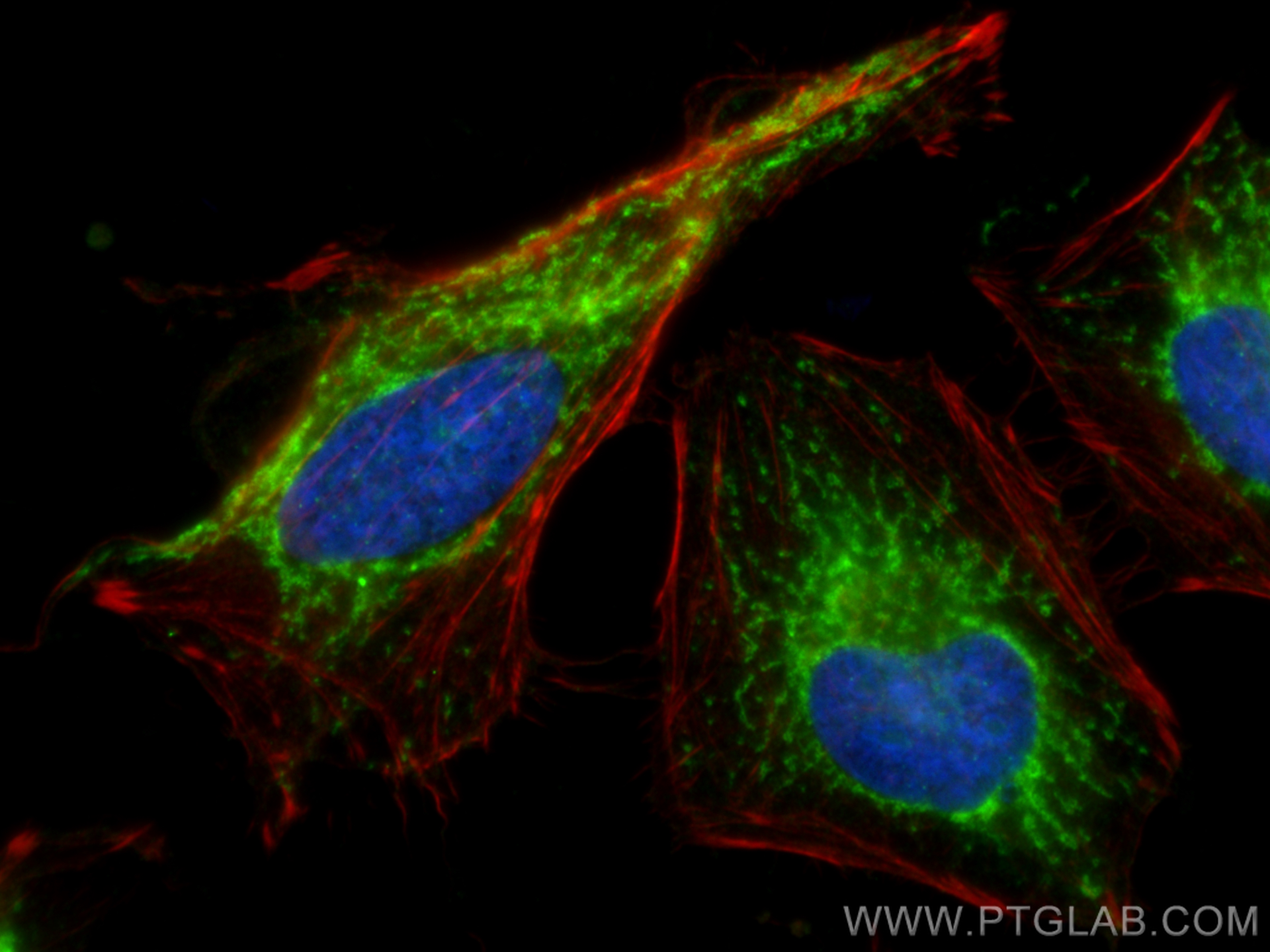 IF Staining of HeLa using 11375-1-AP