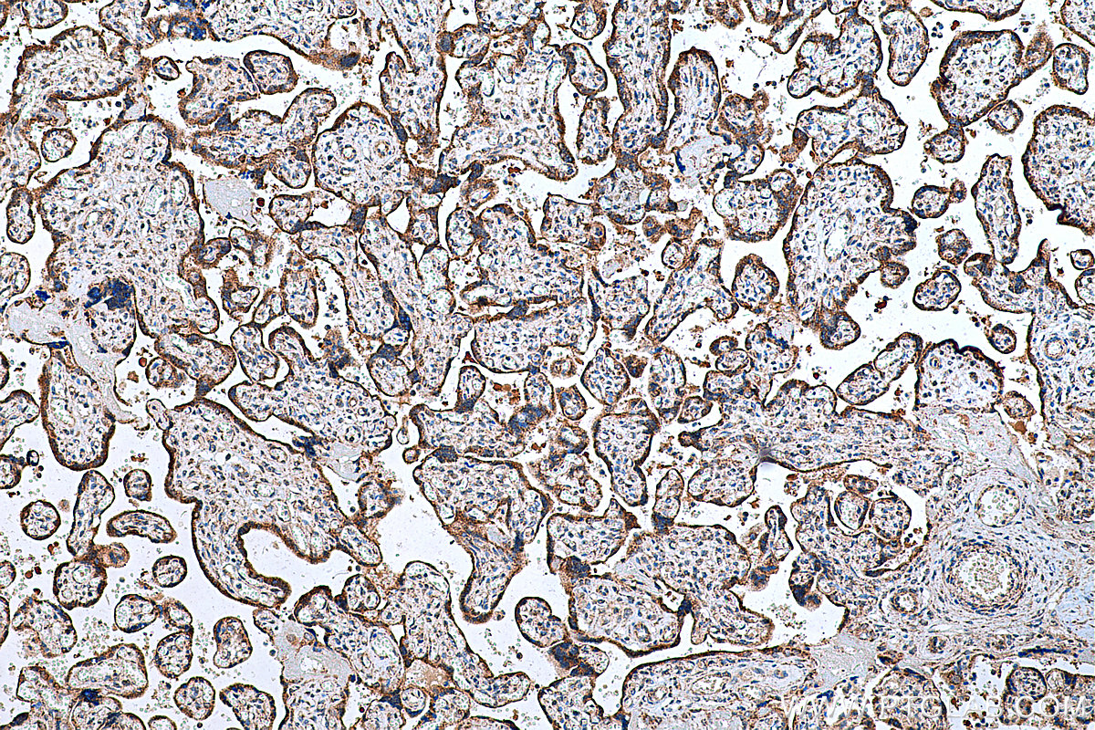 IHC staining of human placenta using 11375-1-AP