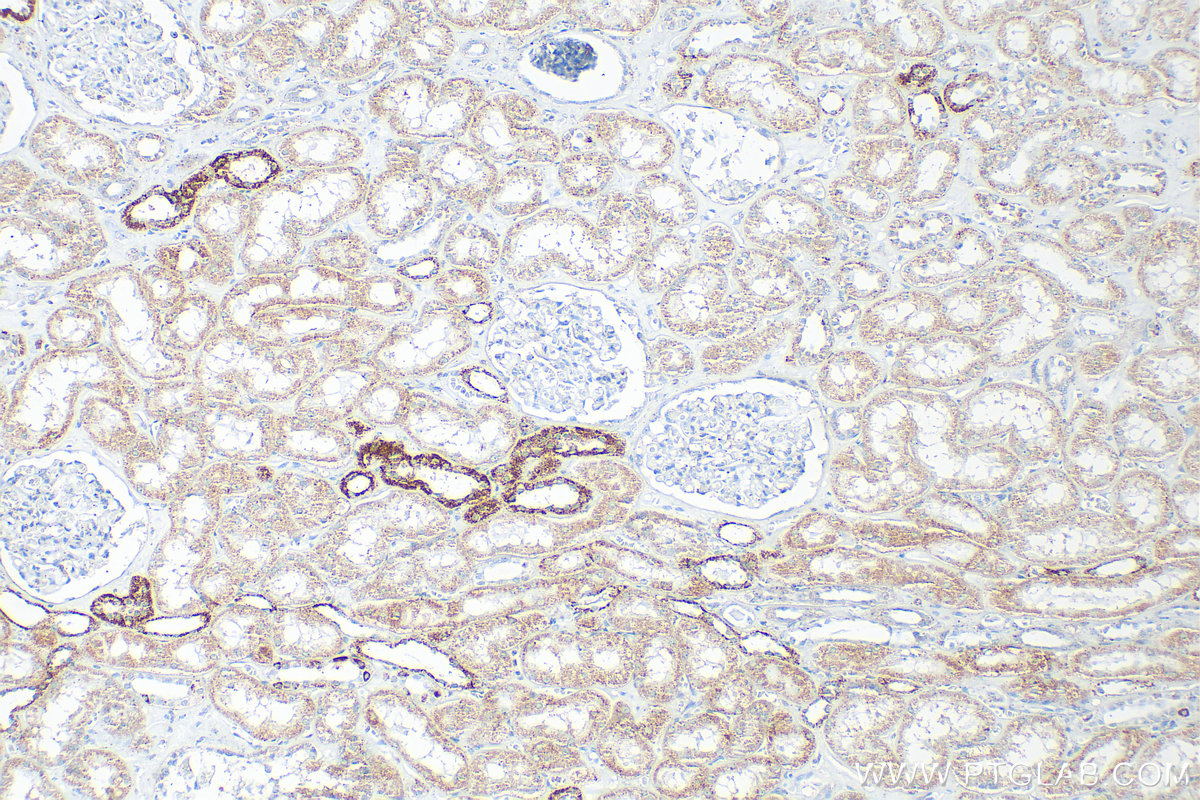 Immunohistochemical analysis of paraffin-embedded human kidney tissue slide using 11375-1-AP (FH antibody) at dilution of 1:4000 (under 10x lens). Heat mediated antigen retrieval with Tris-EDTA buffer (pH 9.0). IHC staining of human kidney using 11375-1-AP