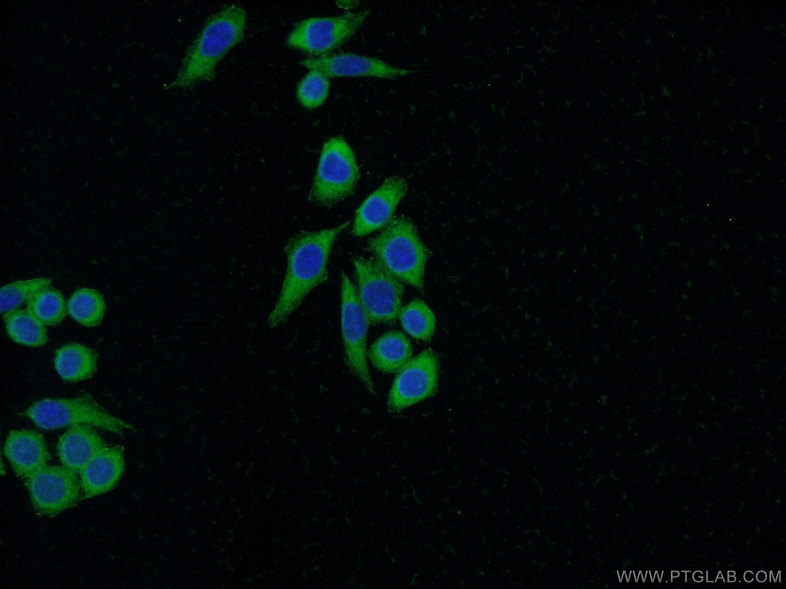 IF Staining of HeLa using 21619-1-AP
