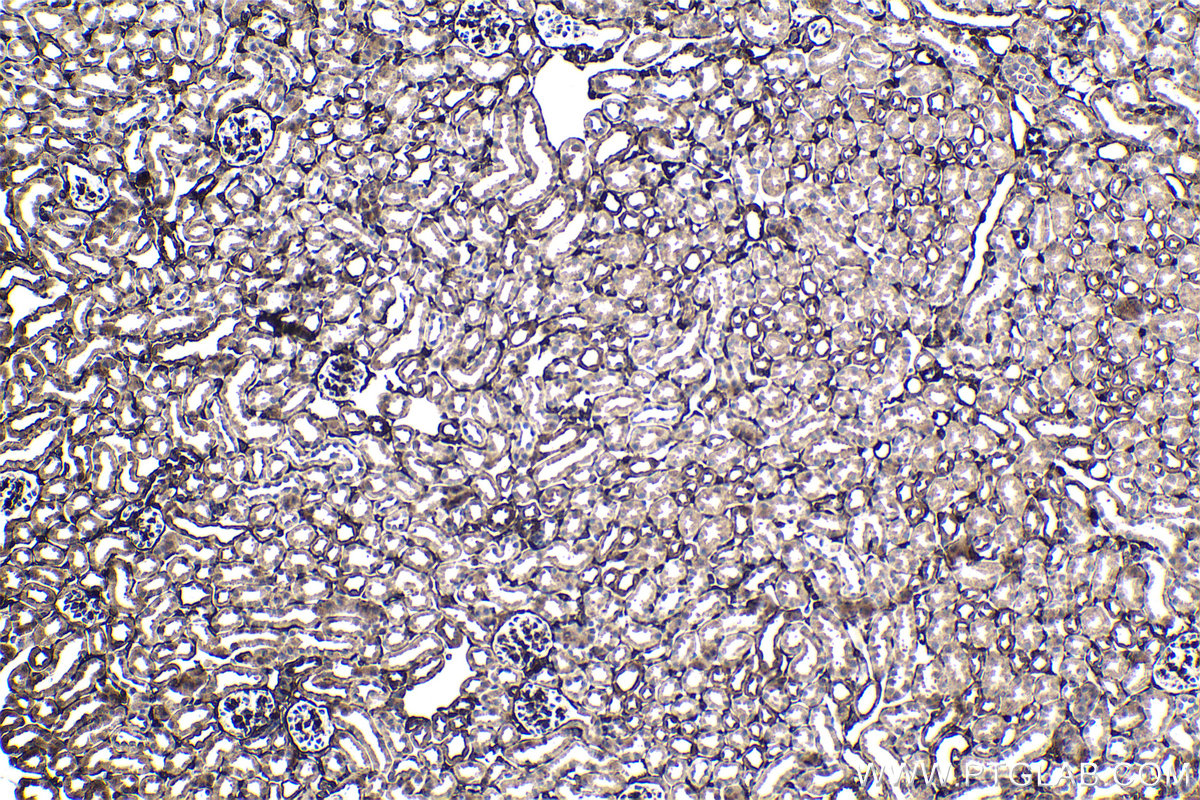 IHC staining of mouse kidney using 21619-1-AP