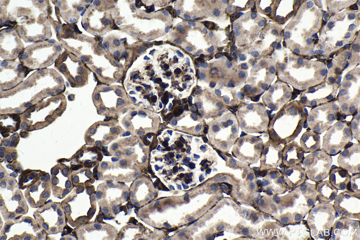 IHC staining of mouse kidney using 21619-1-AP