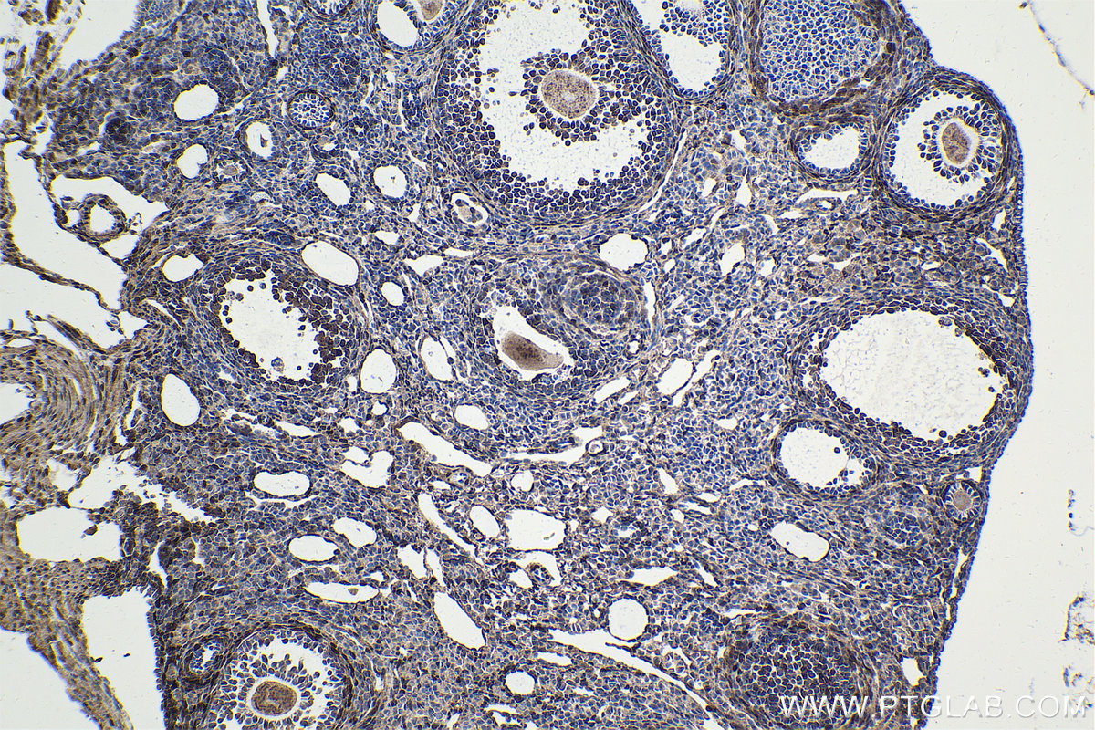 IHC staining of mouse ovary using 21619-1-AP