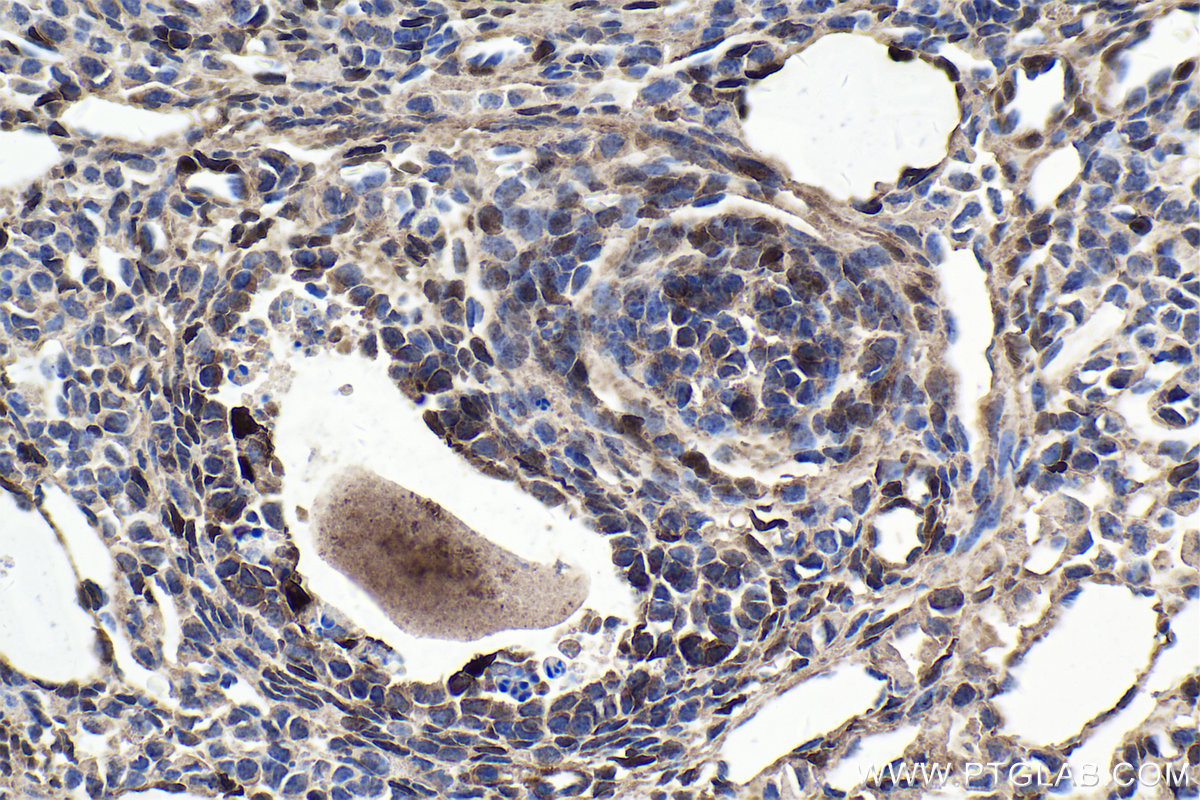 IHC staining of mouse ovary using 21619-1-AP