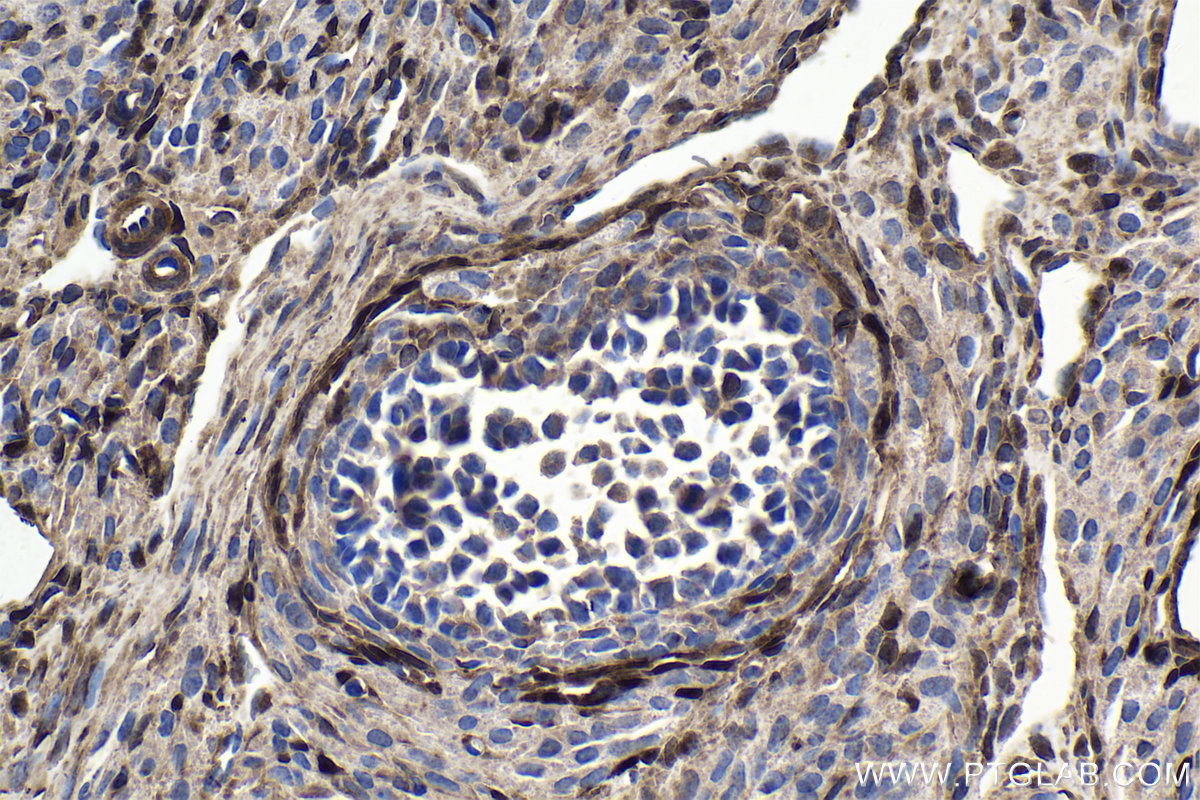IHC staining of rat ovary using 21619-1-AP