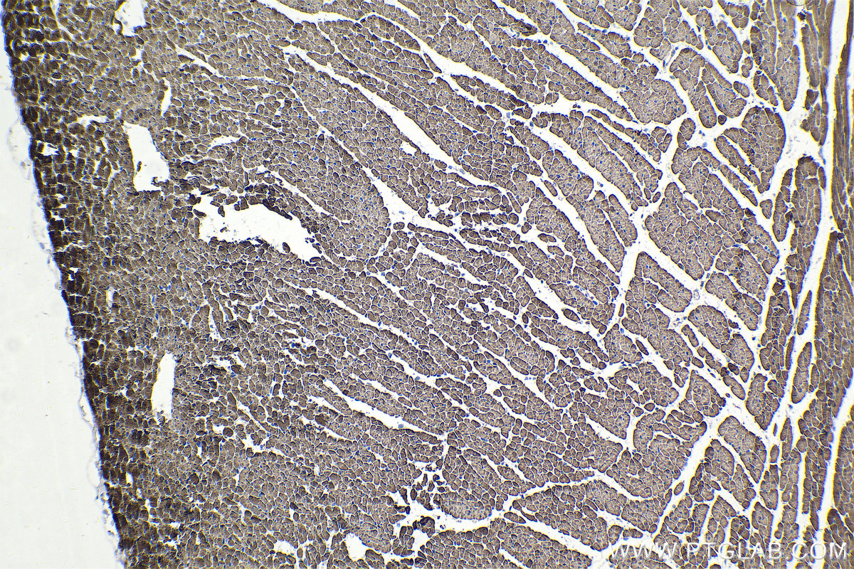 IHC staining of rat heart using 21619-1-AP