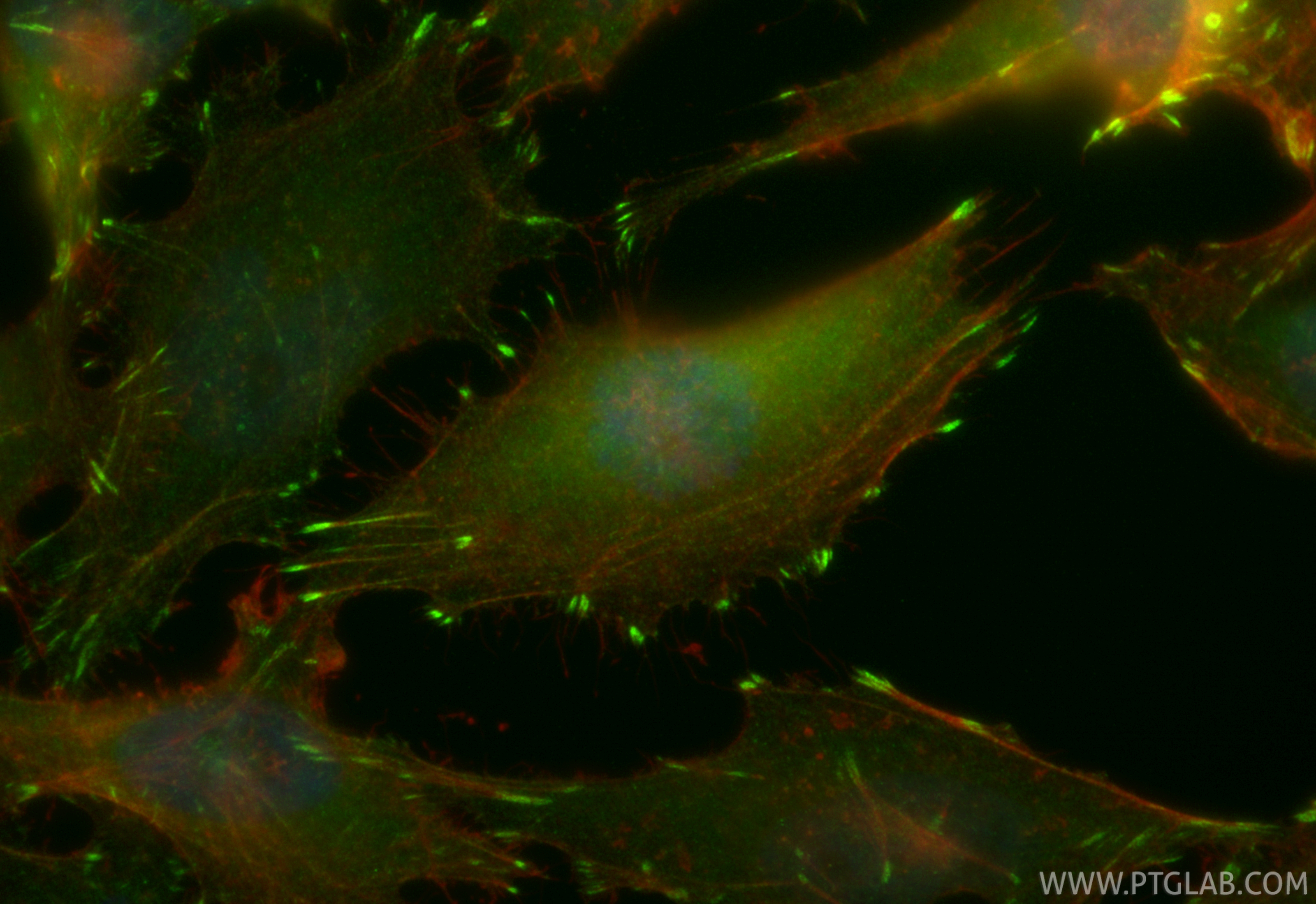 IF Staining of HeLa using CL488-86060