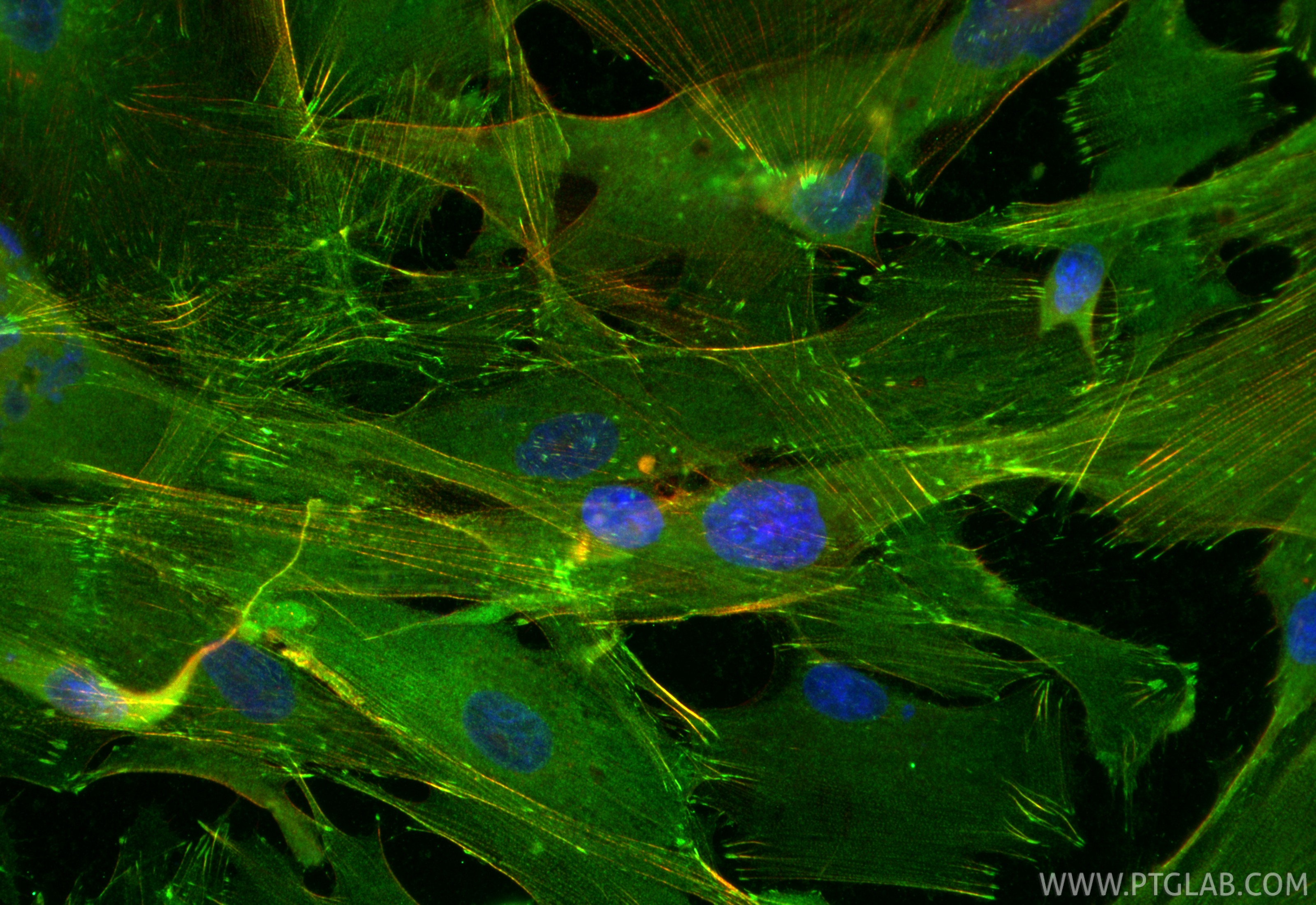 IF Staining of HSkMC using RMX00084 IF Staining of HSkMC using RMX00084
