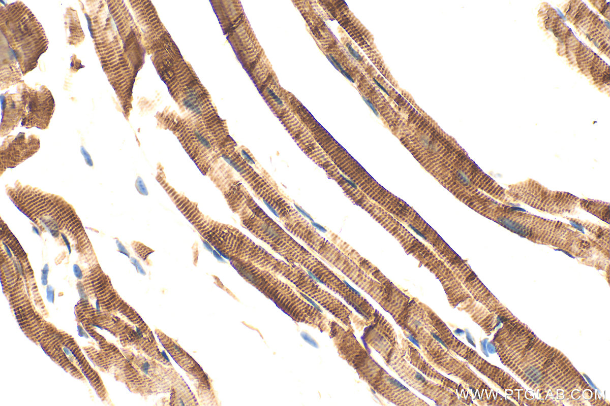 IHC staining of mouse heart using RMX00084 IHC staining of mouse heart using RMX00084