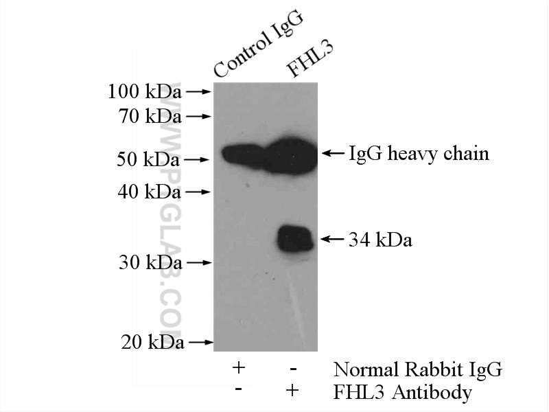 IP experiment of K-562 using 11028-2-AP