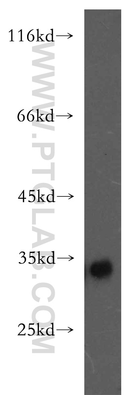 WB analysis of K-562 using 11028-2-AP