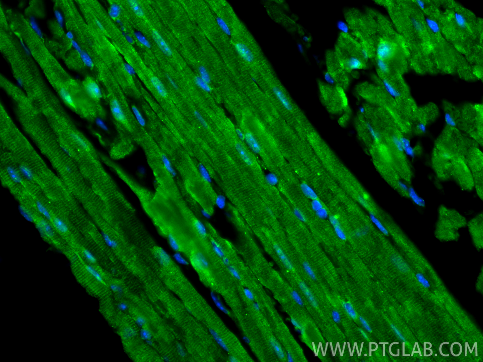 Immunofluorescent analysis of (4% PFA) fixed paraffin-embedded mouse heart tissue using FHOD3 antibody (31744-1-AP) at dilution of 1:200 and CoraLite®488-Conjugated Goat Anti-Rabbit IgG(H+L) (<a class='green' href='/productredirect?CatalogNo=SA00013-2' target='_blank'>SA00013-2</a>). Heat mediated antigen retrieval with Tris-EDTA buffer (pH 9.0). IF Staining of mouse heart using 31744-1-AP