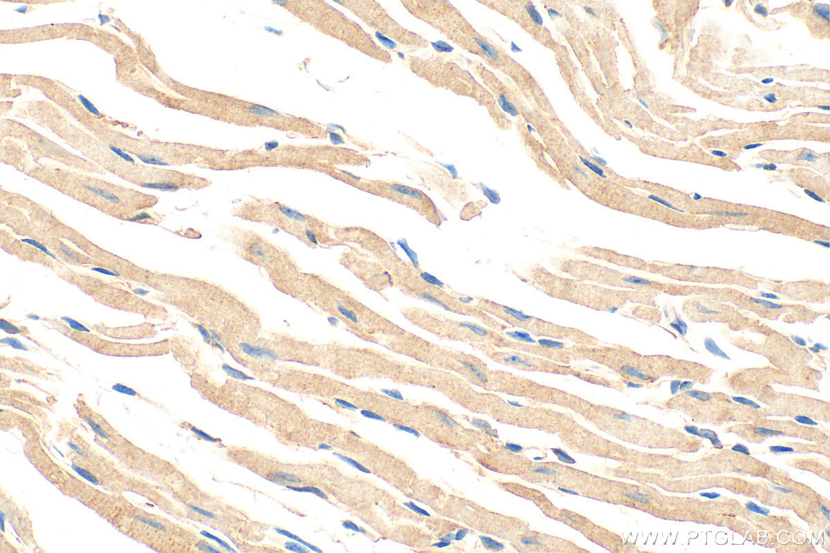 Immunohistochemical analysis of paraffin-embedded mouse heart tissue slide using 31744-1-AP (FHOD3 antibody) at dilution of 1:200 (under 40x lens). Heat mediated antigen retrieval with Tris-EDTA buffer (pH 9.0). IHC staining of mouse heart using 31744-1-AP