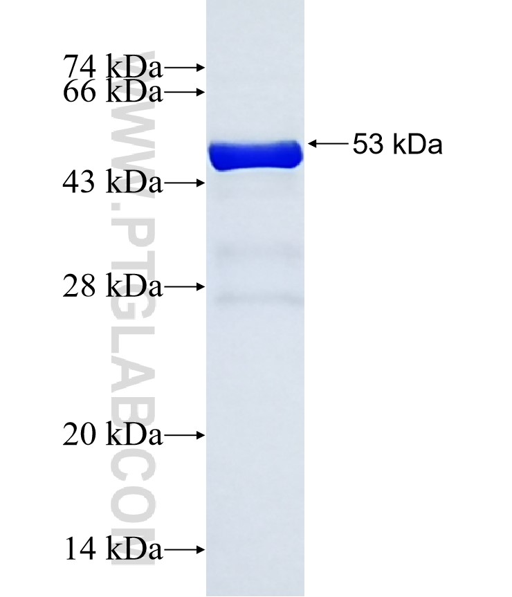 FHOD3 fusion protein Ag37378 SDS-PAGE FHOD3 fusion protein Ag37378 SDS-PAGE