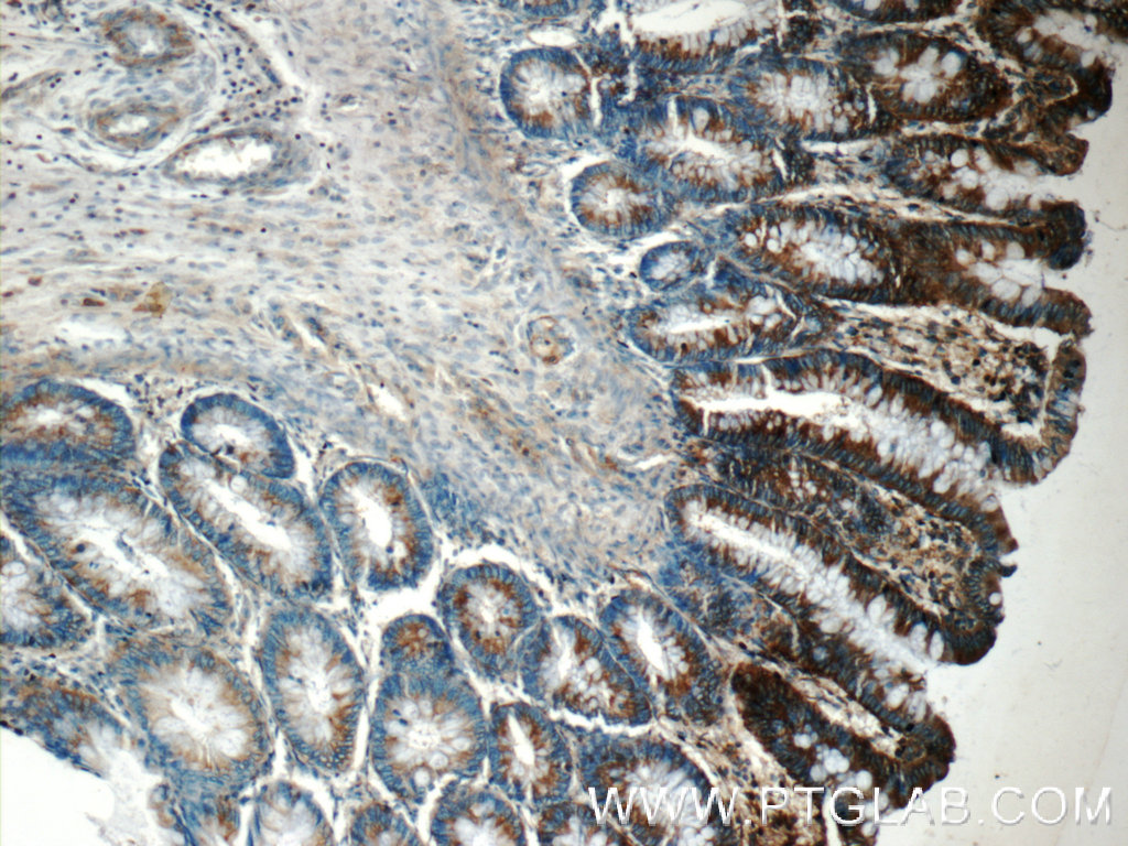 IHC staining of human colon using 25125-1-AP