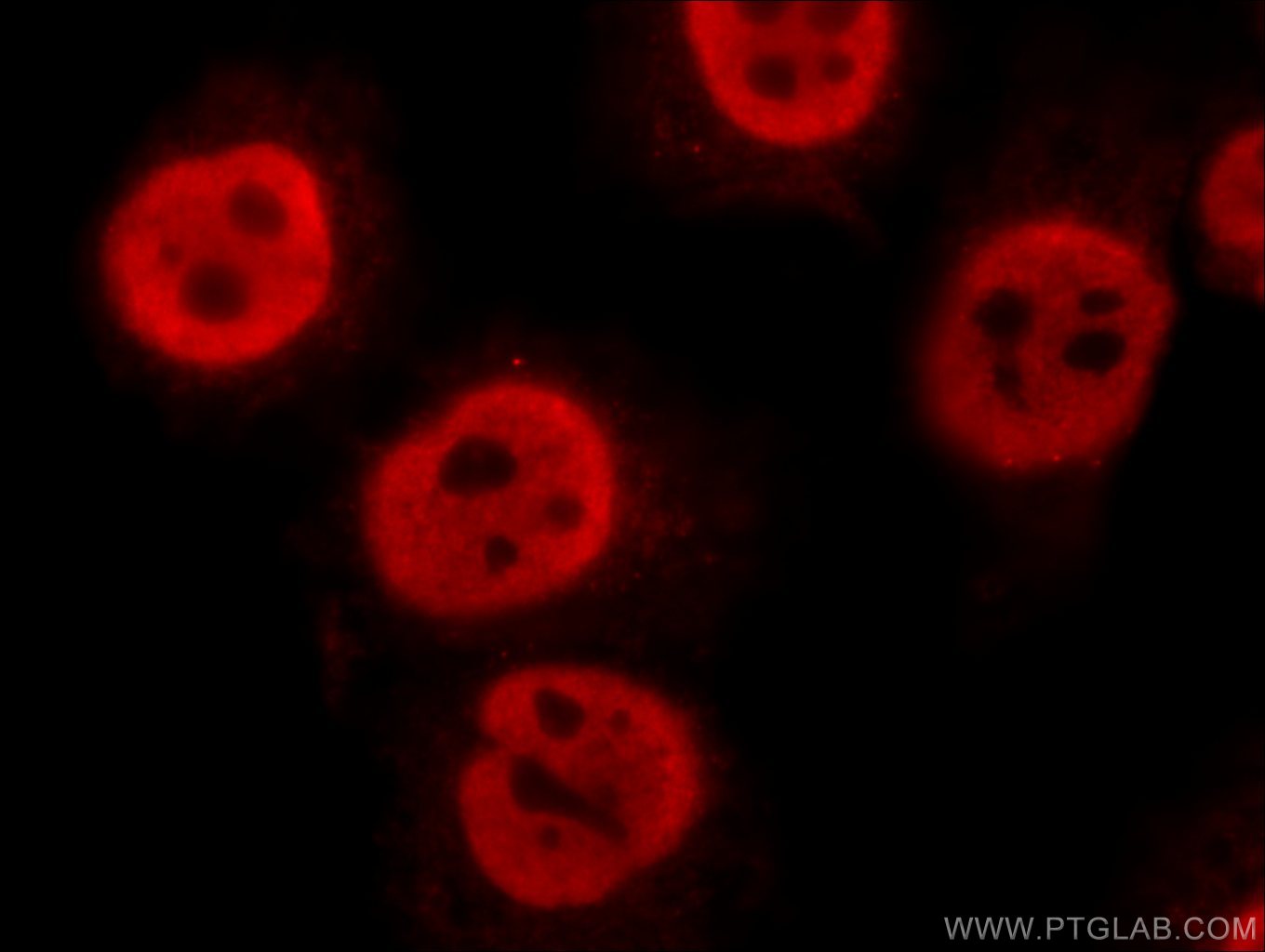 IF Staining of HepG2 using 15968-1-AP