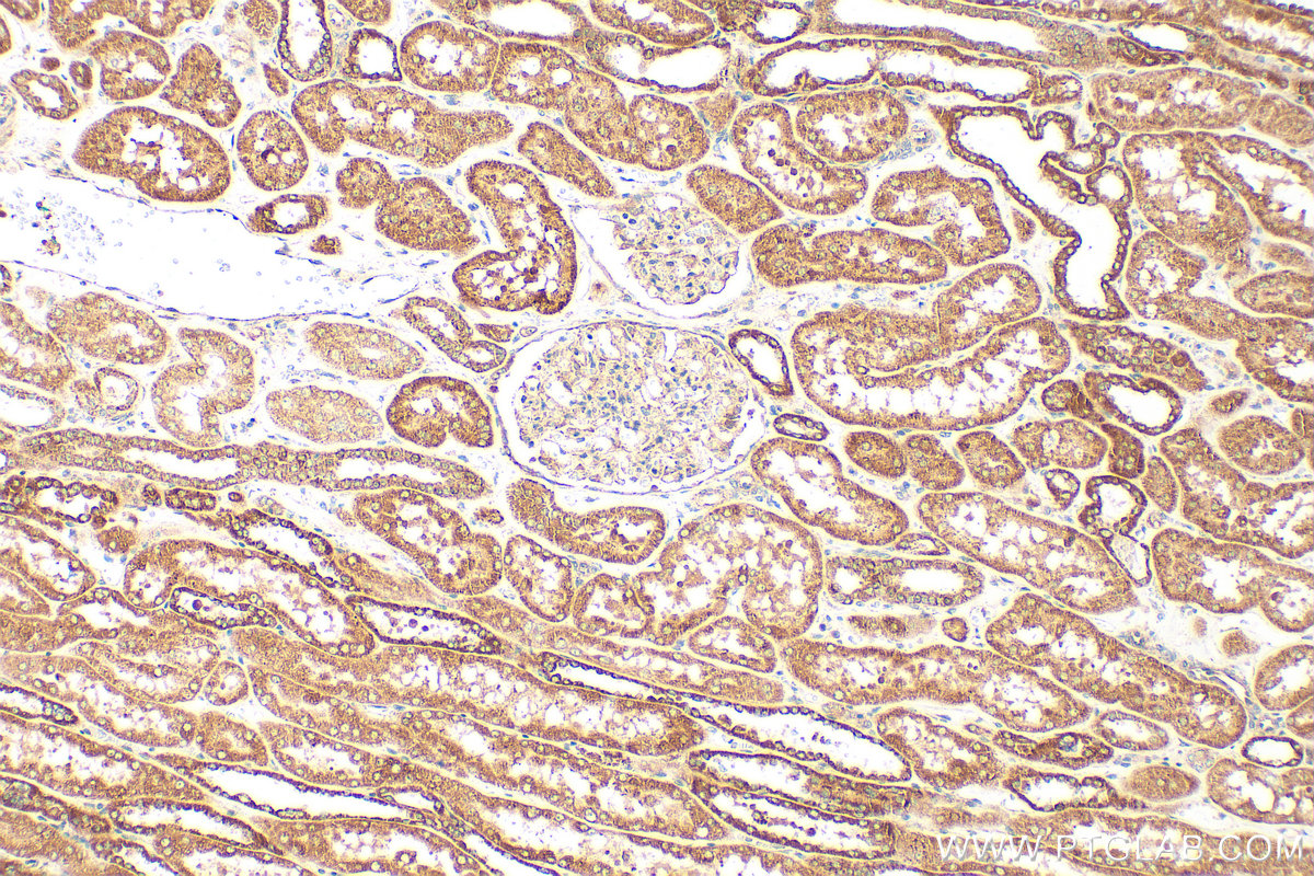 IHC staining of human kidney using 11974-1-AP