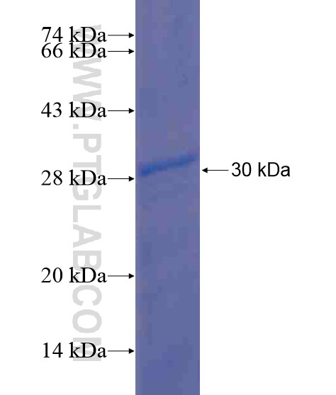 FIGLA fusion protein Ag20206 SDS-PAGE