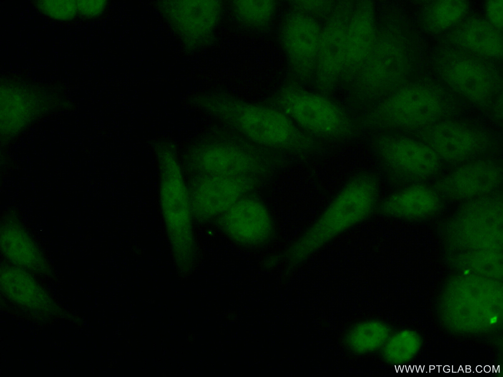 IF Staining of HeLa using 17604-1-AP