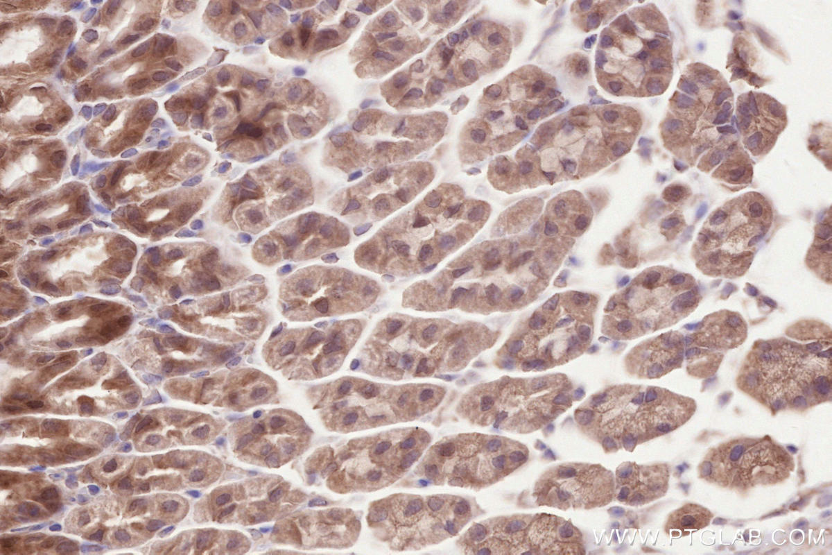 IHC staining of mouse stomach using 17604-1-AP IHC staining of mouse stomach using 17604-1-AP