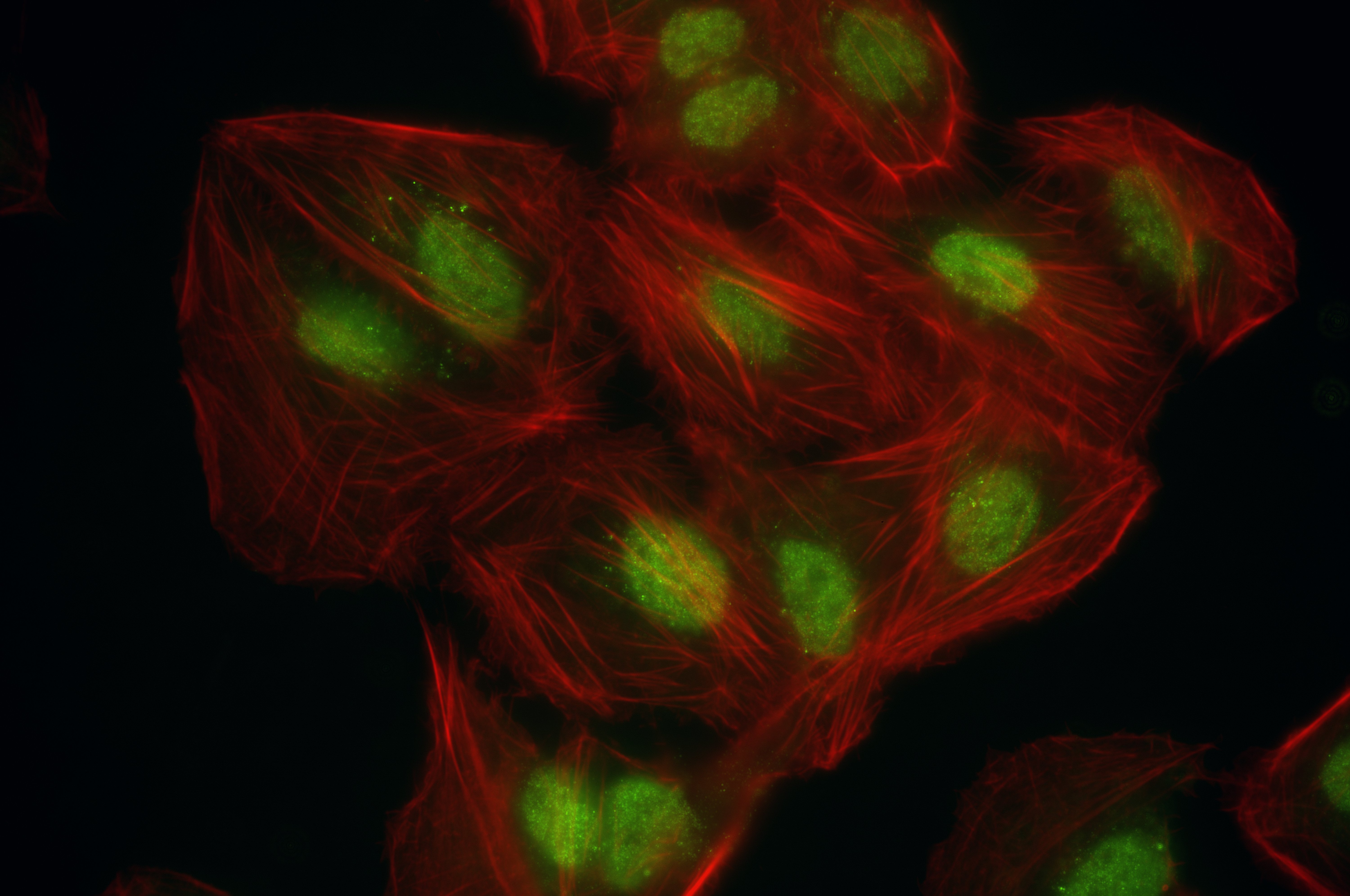 IF Staining of U2OS using 86971-2-RR IF Staining of U2OS using 86971-2-RR