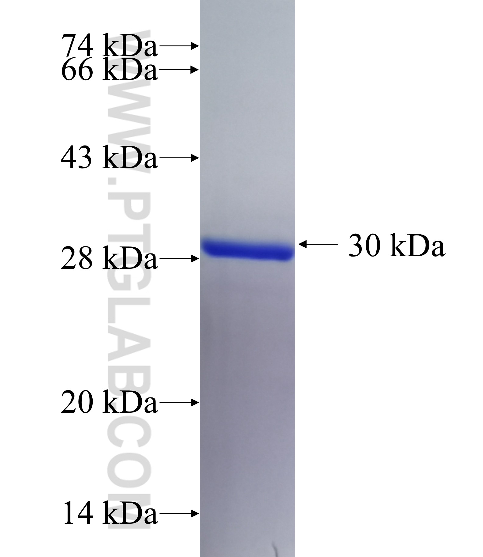FILIP1 fusion protein Ag35099 SDS-PAGE