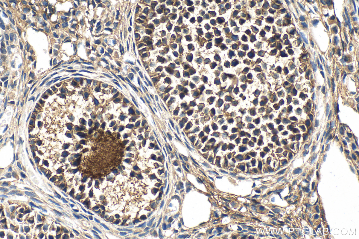 IHC staining of mouse ovary using 30134-1-AP (same clone as 30134-1-PBS)