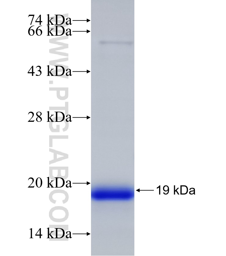 FILIP1L fusion protein Ag32680 SDS-PAGE FILIP1L fusion protein Ag32680 SDS-PAGE