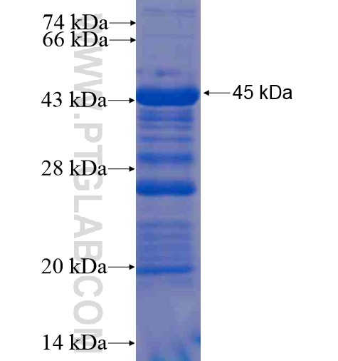 FILIP1L fusion protein Ag11091 SDS-PAGE FILIP1L fusion protein Ag11091 SDS-PAGE