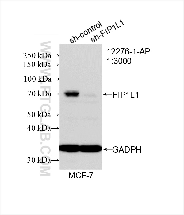 WB analysis of MCF-7 using 12276-1-AP