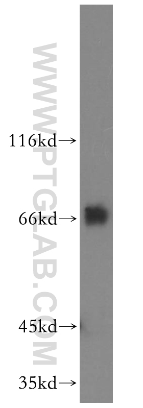 WB analysis of K-562 using 12276-1-AP