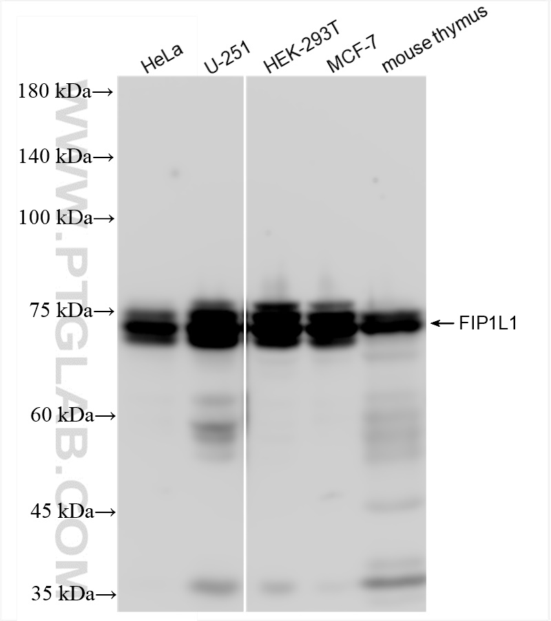 WB analysis using 83863-2-RR (same clone as 83863-2-PBS)