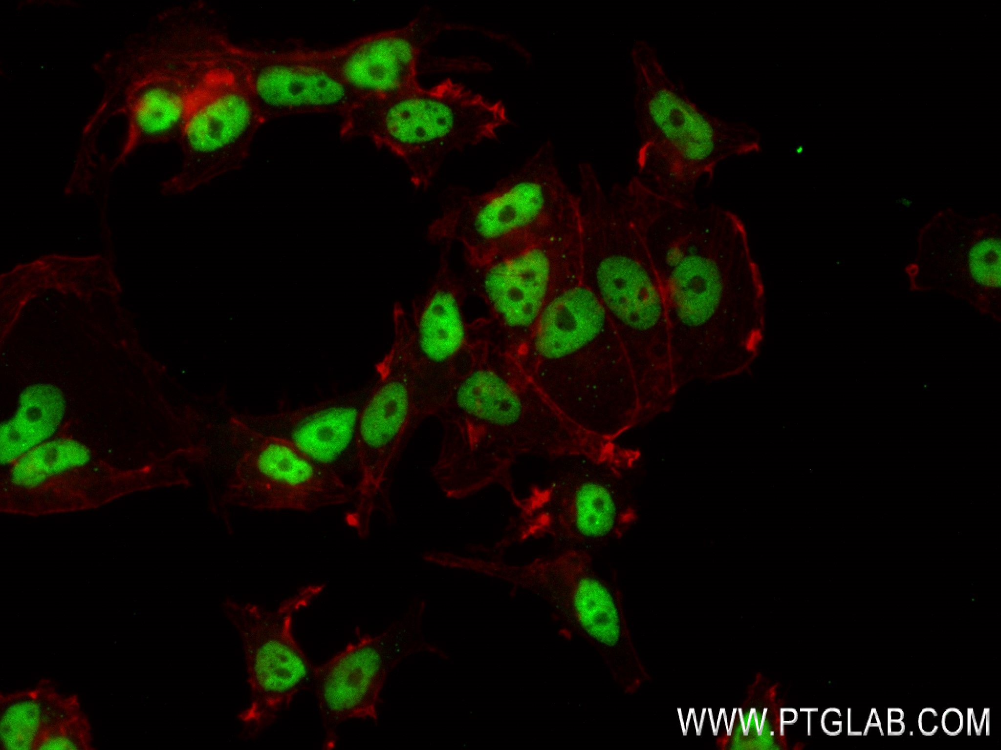 IF Staining of MCF-7 using 83863-3-RR (same clone as 83863-3-PBS)