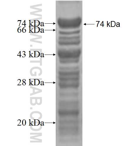 FIP1L1 fusion protein Ag2921 SDS-PAGE