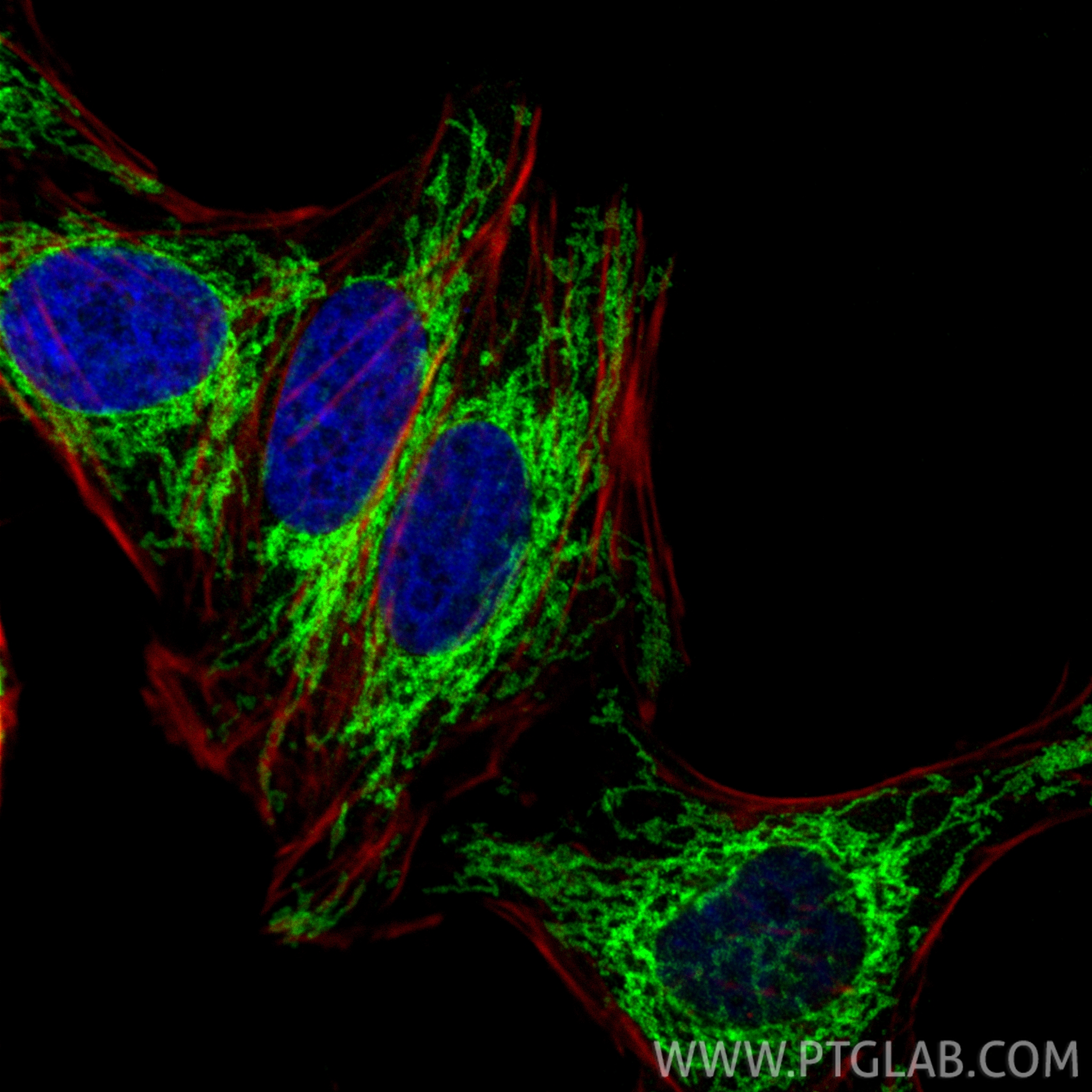 IF Staining of HepG2 using 10956-1-AP IF Staining of HepG2 using 10956-1-AP
