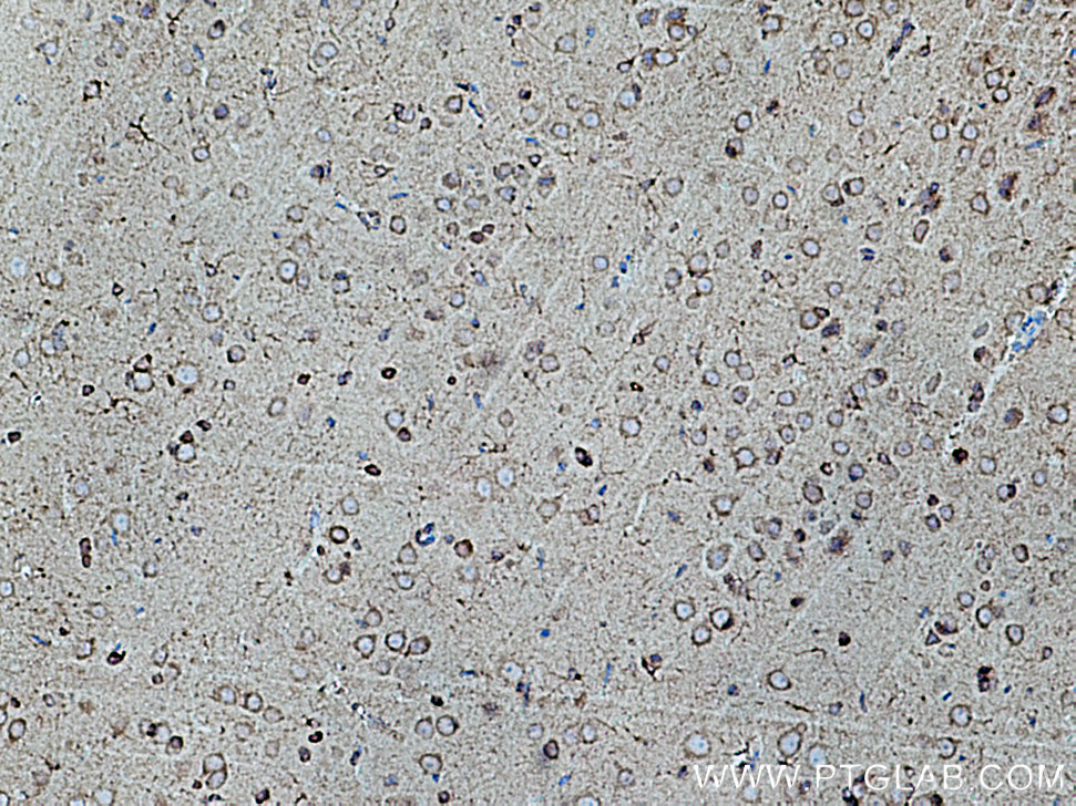 IHC staining of rat brain using 10956-1-AP