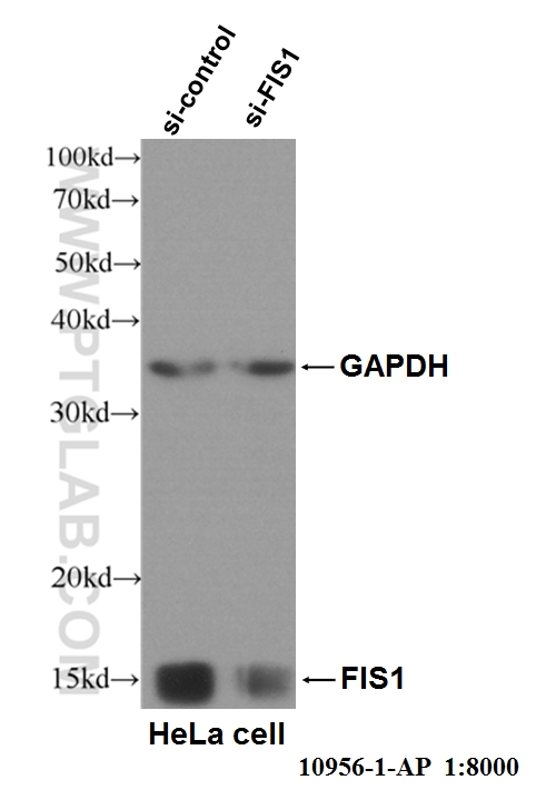 FIS1 Polyclonal antibody