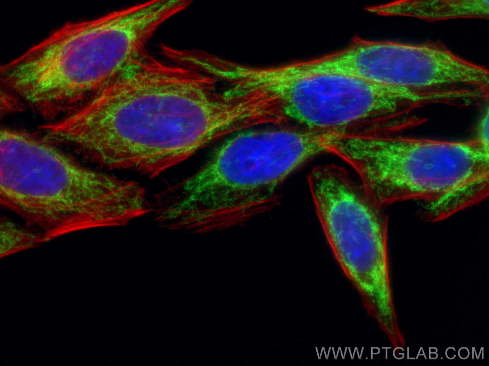 IF Staining of HepG2 using 82248-1-RR (same clone as 82248-1-PBS)