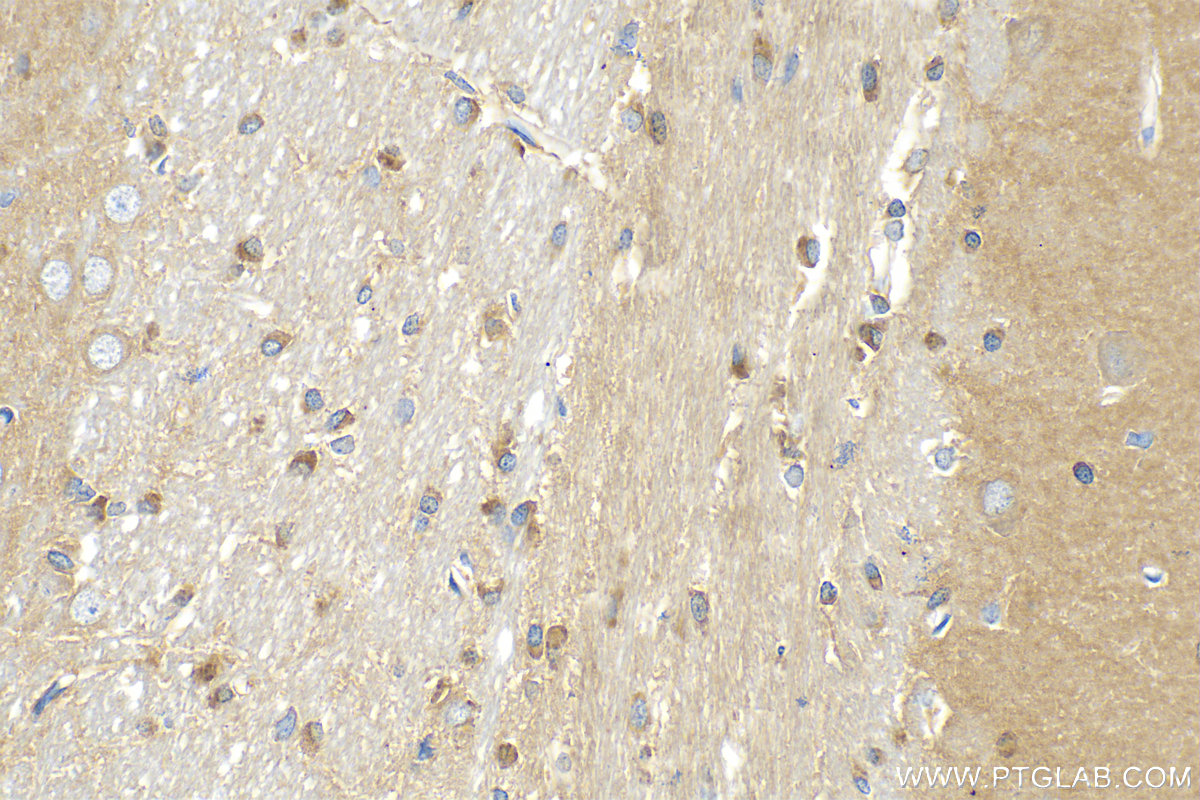 IHC staining of rat brain using 82248-1-RR (same clone as 82248-1-PBS)