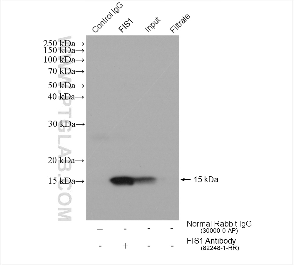 IP experiment of HeLa using 82248-1-RR (same clone as 82248-1-PBS)