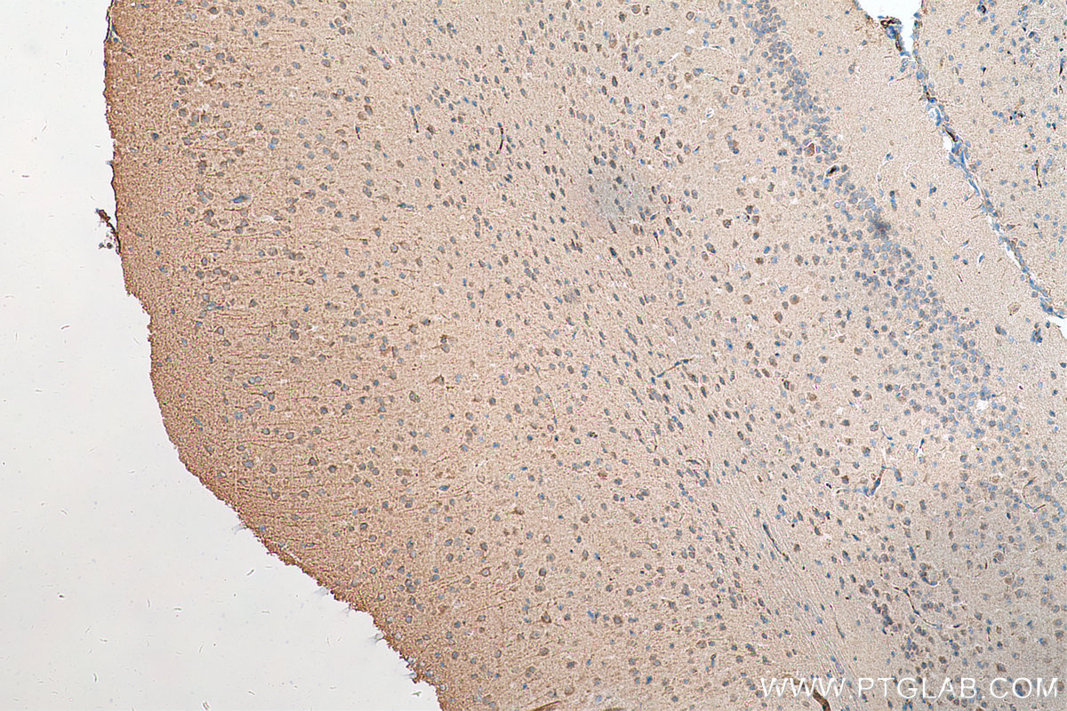 IHC staining of mouse brain using 17417-1-AP