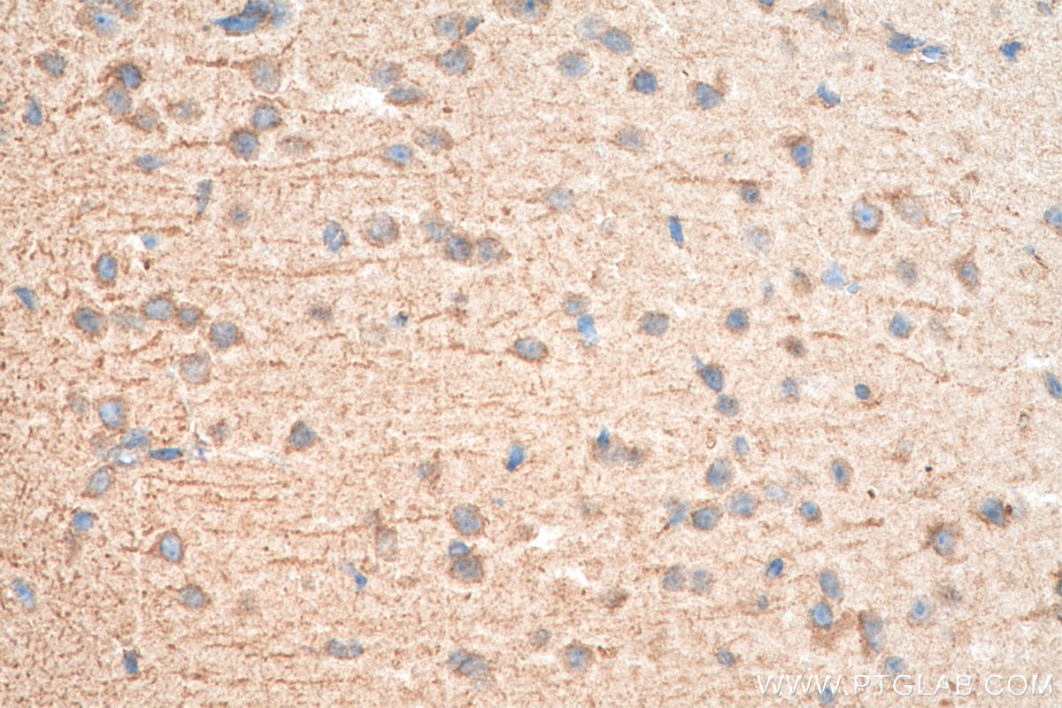 IHC staining of mouse brain using 17417-1-AP