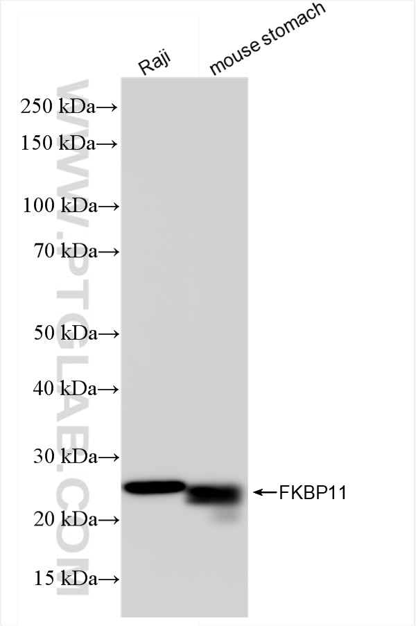 FKBP11