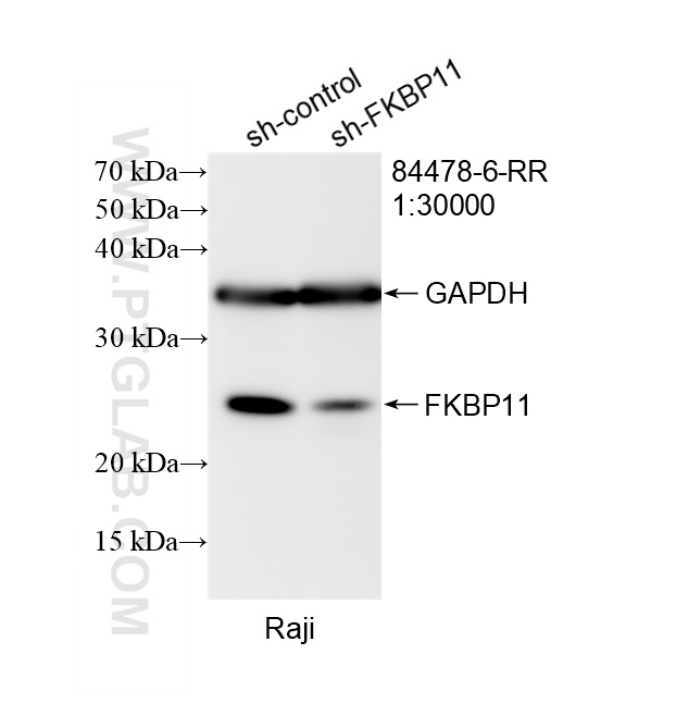 WB result of FKBP11 antibody (84478-6-RR; 1:30000; incubated at room temperature for 1.5 hours) with sh-Control and sh-FKBP11 transfected Raji cells. WB analysis of Raji using 84478-6-RR