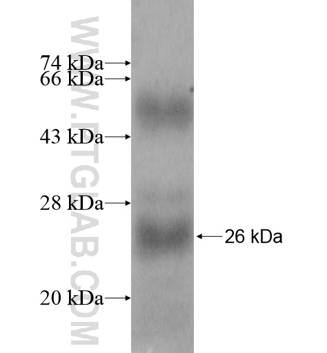 FKBP11 fusion protein Ag11110 SDS-PAGE FKBP11 fusion protein Ag11110 SDS-PAGE