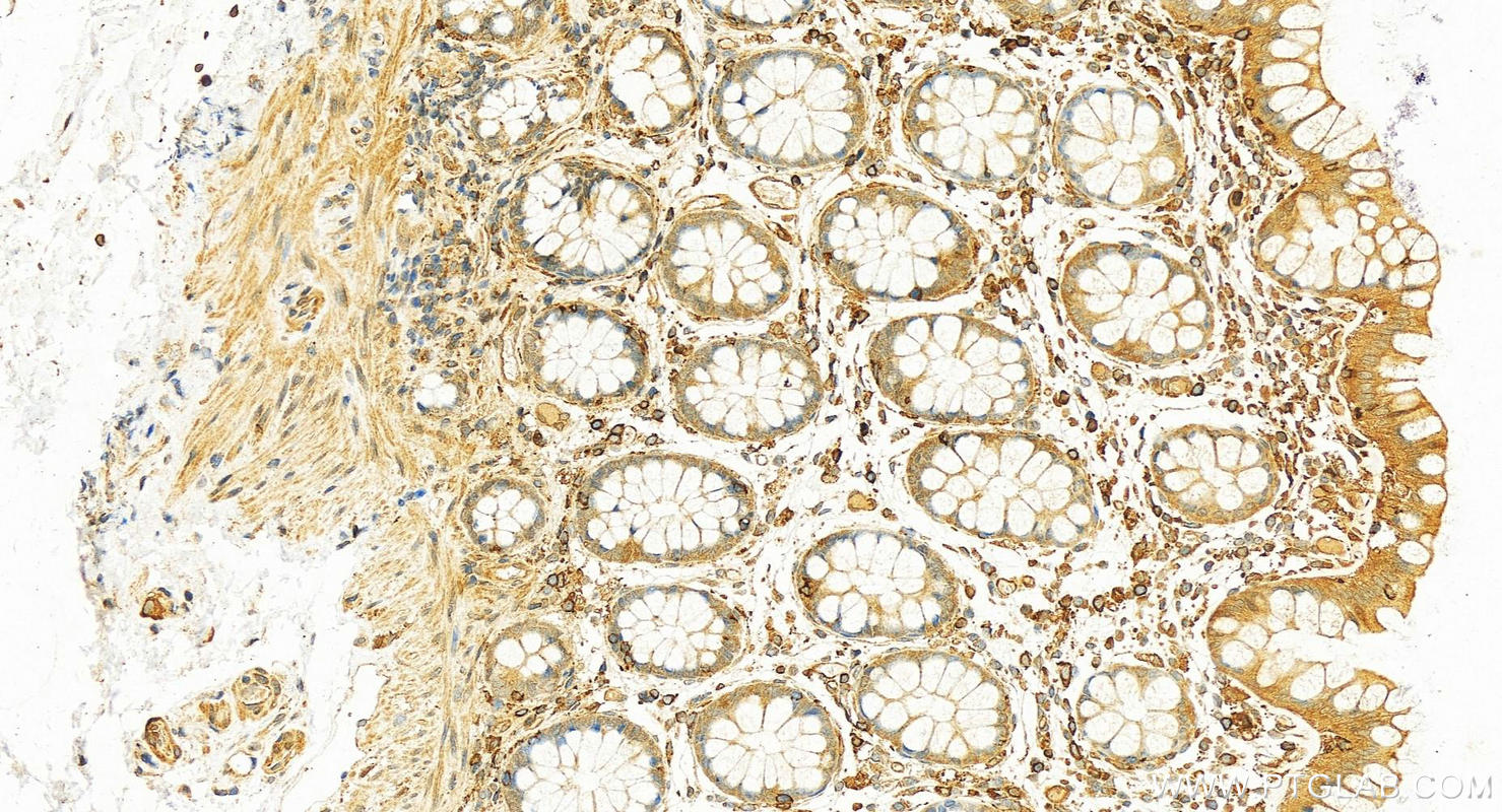 IHC staining of human colon using 10273-1-AP