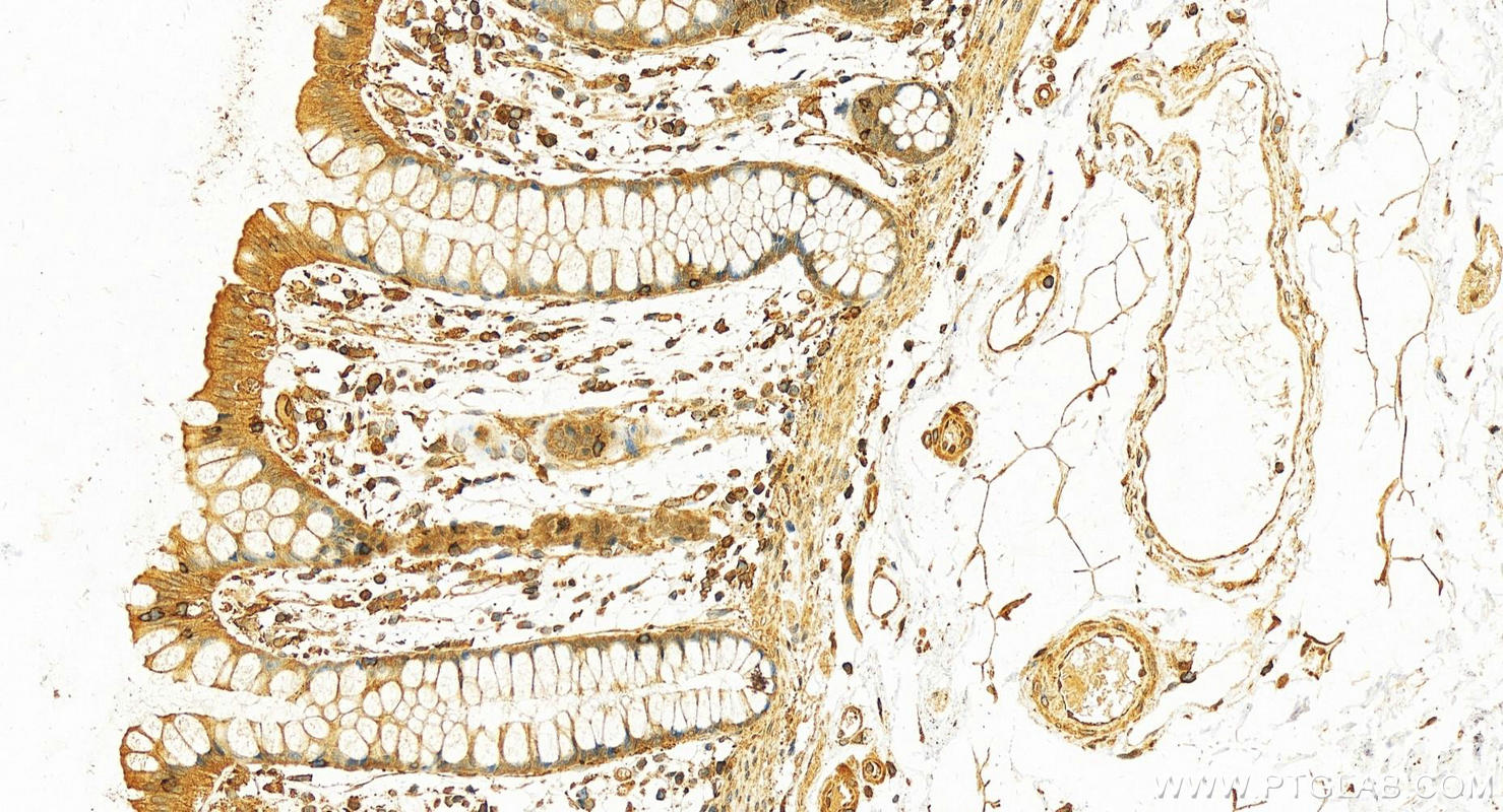 IHC staining of human colon using 10273-1-AP