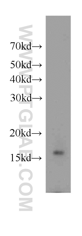 WB analysis of mouse cerebellum using 11700-1-AP