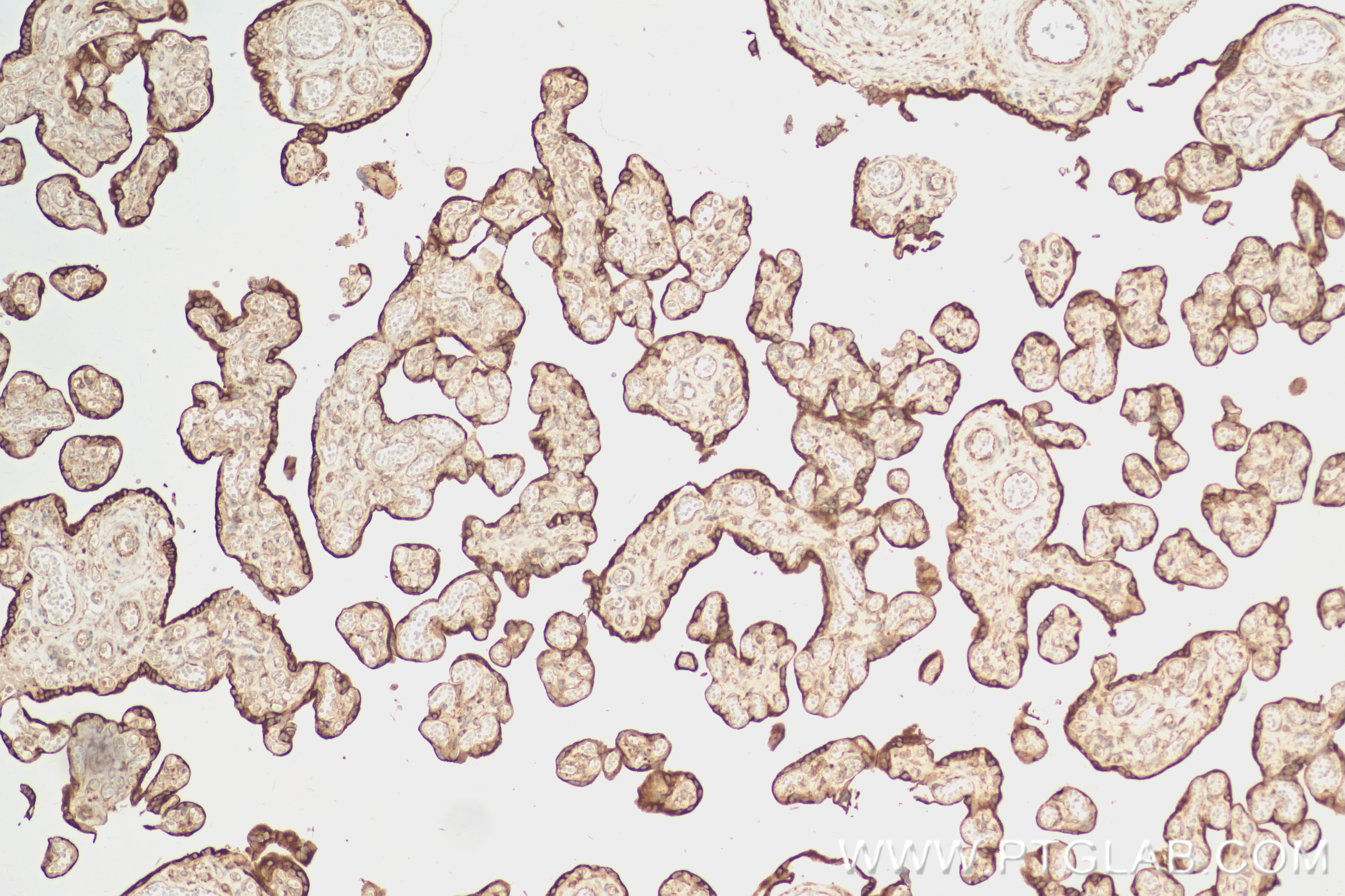 IHC staining of human placenta using 84077-6-RR (same clone as 84077-6-PBS)