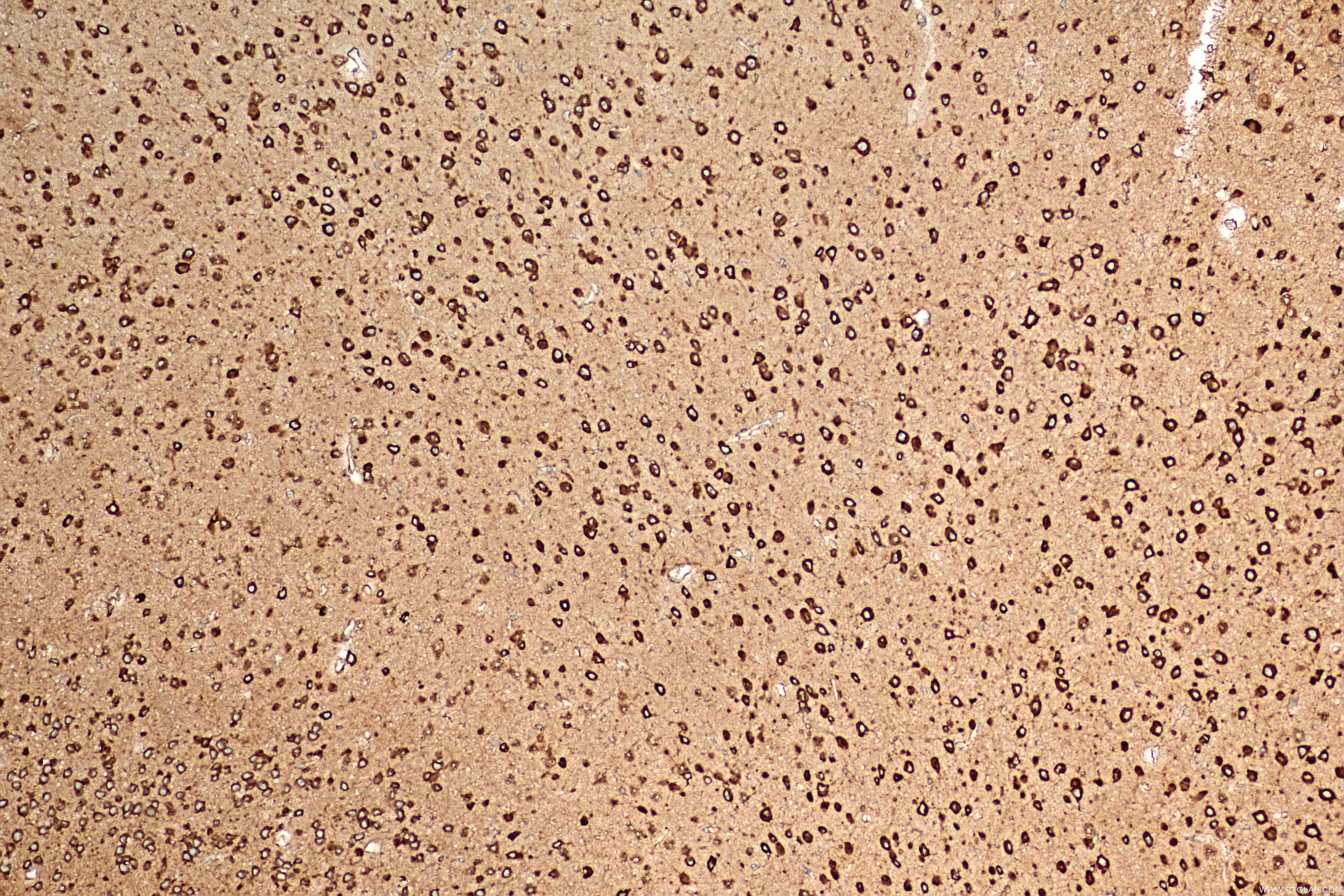 IHC staining of mouse brain using 84077-6-RR (same clone as 84077-6-PBS)